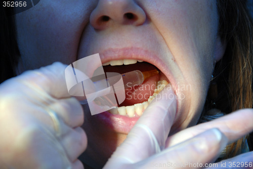 Image of injection at the dentist