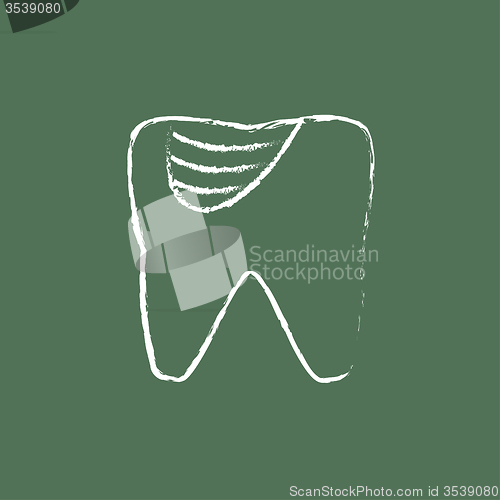 Image of Tooth decay icon drawn in chalk.