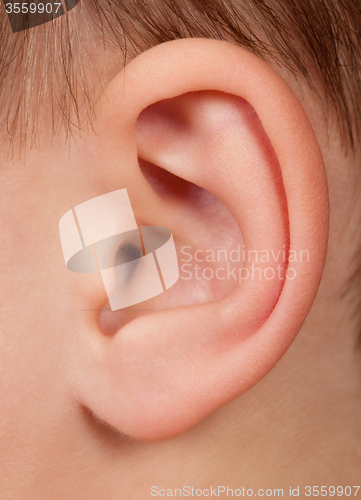 Image of Child ear