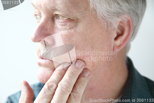 Image of itchy rash on man's face