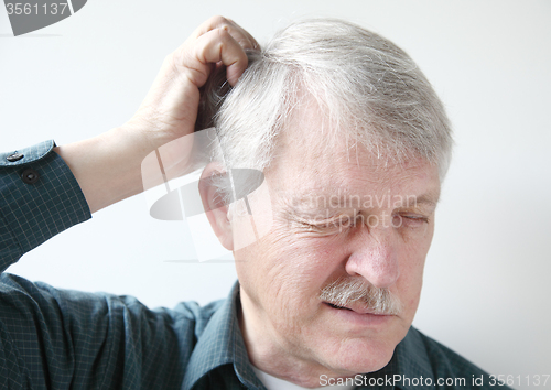 Image of older man with dry scalp 