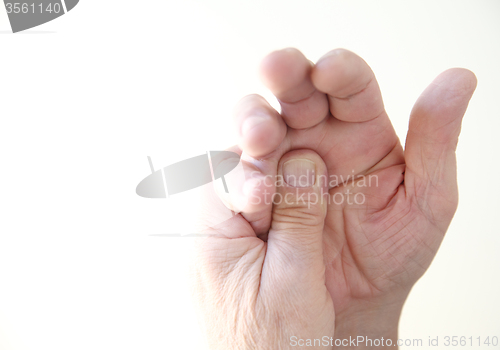 Image of man with pain at base of fingers