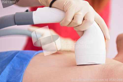 Image of male laser epilation