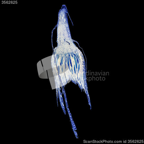 Image of Moss protonemata micrograph