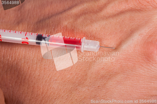 Image of Subcutaneous medical injection concept