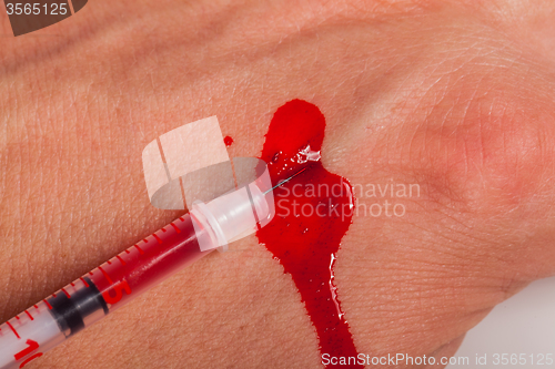 Image of Subcutaneous medical injection concept