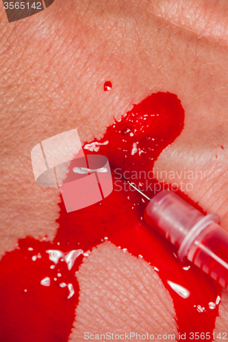 Image of Subcutaneous medical injection concept