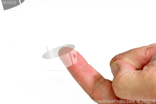 Image of Bloody Forefinger