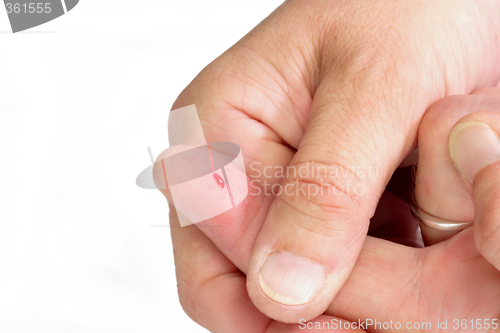 Image of Thumb from a Bloody Finger