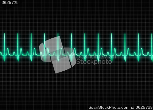 Image of Electrocardiography