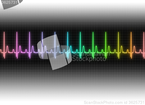 Image of Electrocardiography