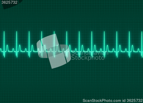 Image of Electrocardiography