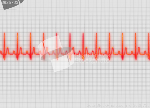 Image of Electrocardiography