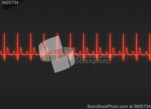 Image of Electrocardiography