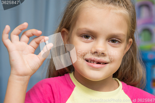 Image of At the five year old girl fell upper front baby tooth