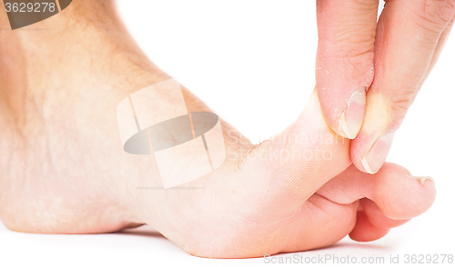 Image of Male person pulling big toe backwards isolated towards white