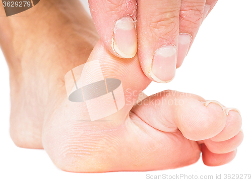 Image of Male person pulling big toe backwards isolated towards white