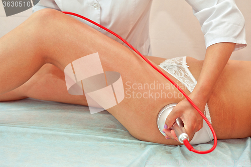 Image of procedure for women hip