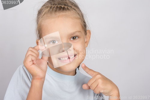 Image of Six year old girl with a smile, pointing at the fallen baby tooth