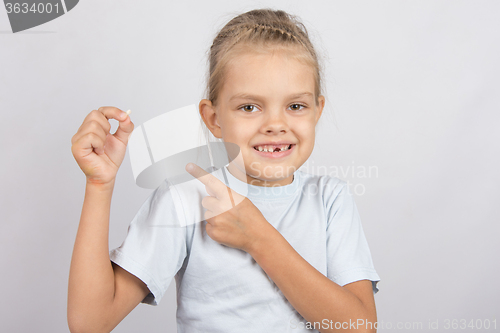 Image of Smiling girl shows a finger on a fallen baby tooth