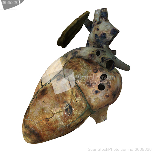 Image of Sick Human Heart