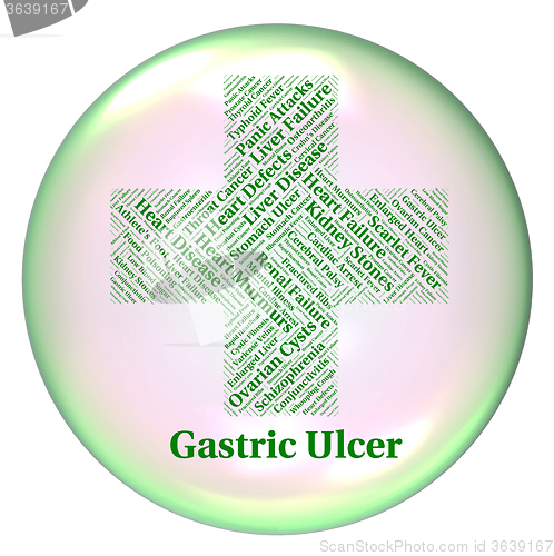Image of Gastric Ulcer Means Open Sore And Cyst