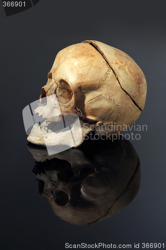 Image of real skull