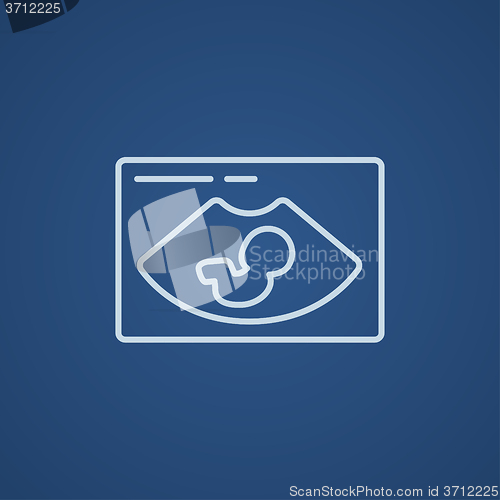 Image of Fetal ultrasound line icon.