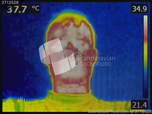 Image of Flu Diagnosis