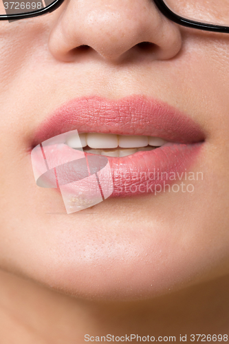 Image of beautiful lips virus infected herpes