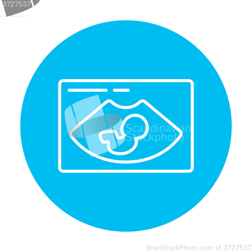 Image of Fetal ultrasound line icon.