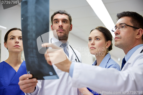 Image of group of doctors looking at x-ray scan image