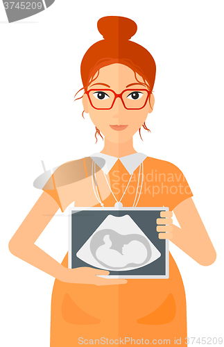 Image of Pregnant woman with ultrasound image.