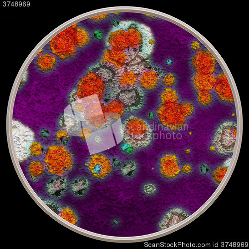 Image of Lichen and fungi under microscope