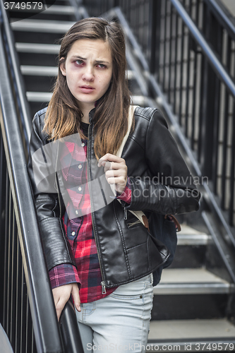 Image of Young Bruised and Frightened Girl With Backpack on Staircase