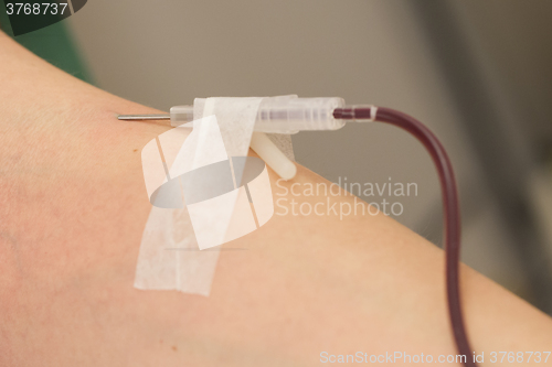 Image of Donor in an armchair donates blood,, close-up