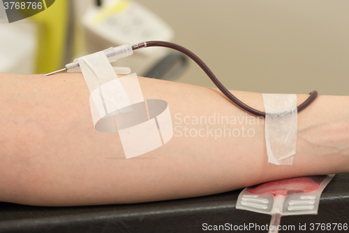 Image of Donor in an armchair donates blood,, close-up
