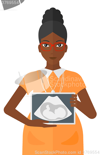 Image of Pregnant woman with ultrasound image.