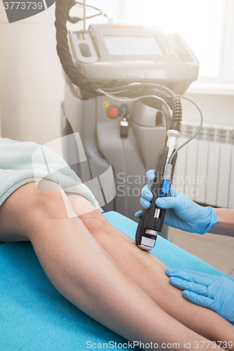 Image of laser legs epilation