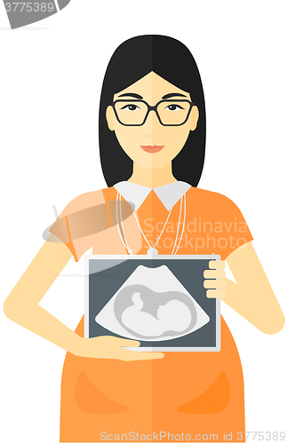 Image of Pregnant woman with ultrasound image.