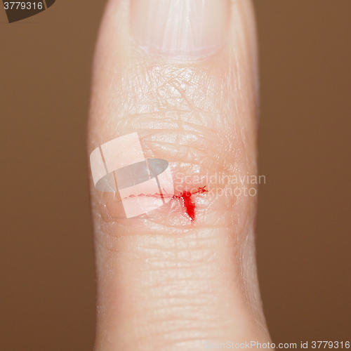 Image of Paper cut with blood