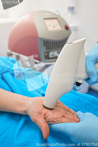 Image of Procedure against hyperhidrosis