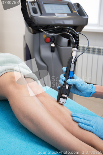 Image of laser legs epilation