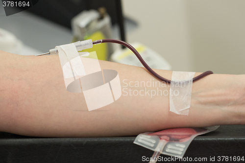 Image of Donor in an armchair donates blood,, close-up