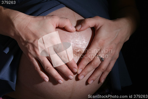 Image of pregnancy