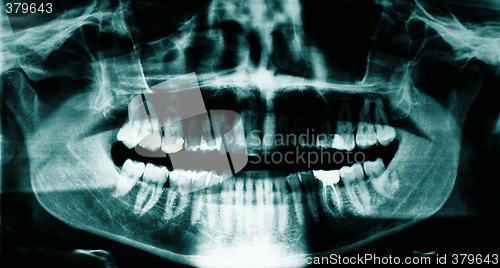 Image of Dental x-ray