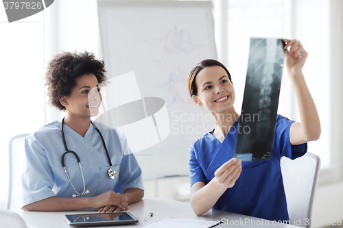 Image of happy female doctors with x-ray image at hospital