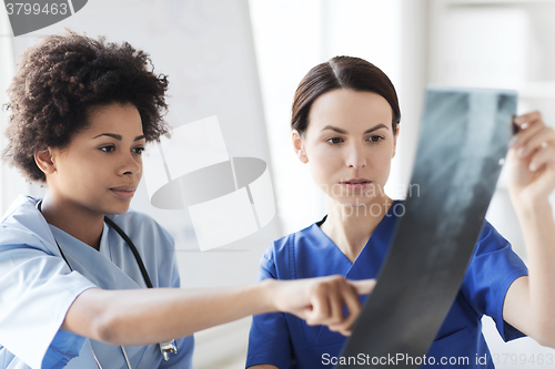 Image of female doctors with x-ray image at hospital