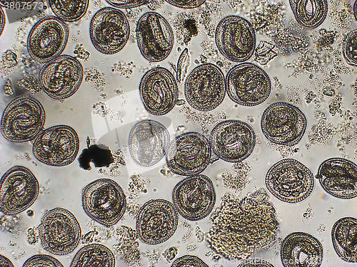 Image of Toxocara cati L-2 larvae in eggs microscope