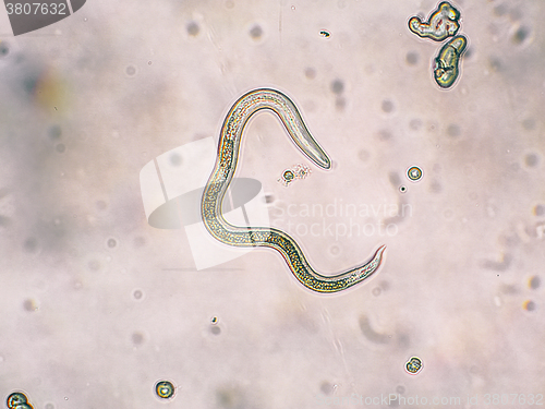 Image of Toxocara canis second stage larvae hatch from eggs